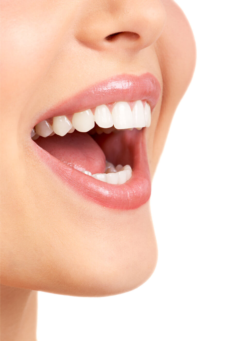 Fraundorfer dentistry teeth whitening